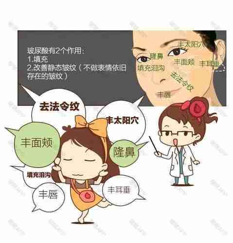 啵啵微整形漫画丨肉毒素和玻尿酸分别打在什么