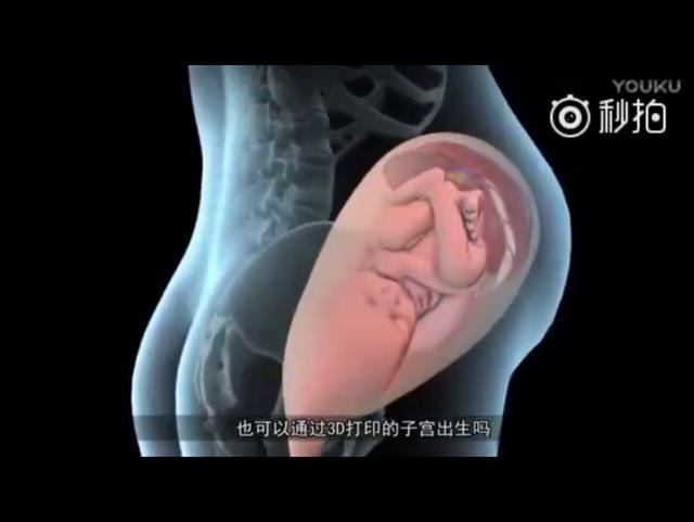 3d打印子宫移植技术（3D打印子宫或将问世）(1)