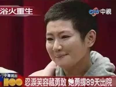 罗志祥在selina烧伤后唱歌（与罗志祥分手经历烧伤）(20)