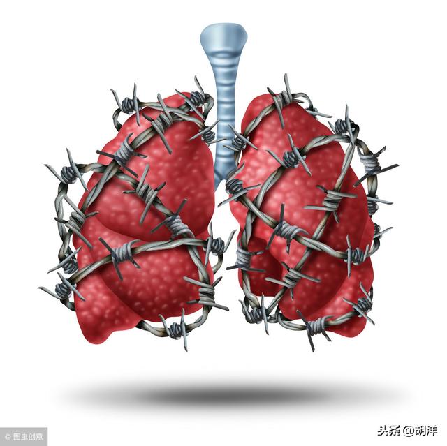 肺纤维化是一种严重的病吗（肺纤维化是一种无法根治的疾病）(2)