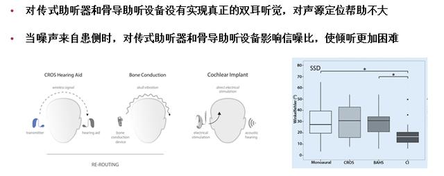 一个单侧耳聋的成功人士（人工辅听在单侧聋中的应用进展）(3)