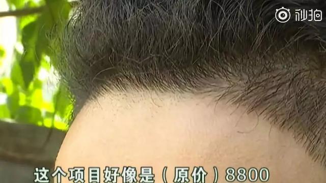 发际线男孩搞笑朋友圈（18岁发际线男孩爆笑刷屏网络）(6)