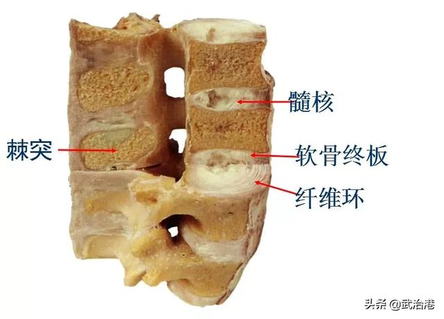 腰椎间盘突出症的正确治疗（腰椎间盘突出症诊断与治疗）(4)