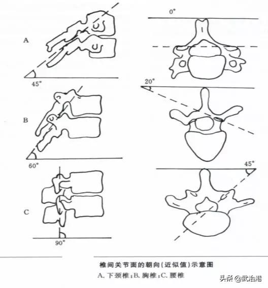 腰椎间盘突出症的正确治疗（腰椎间盘突出症诊断与治疗）(2)